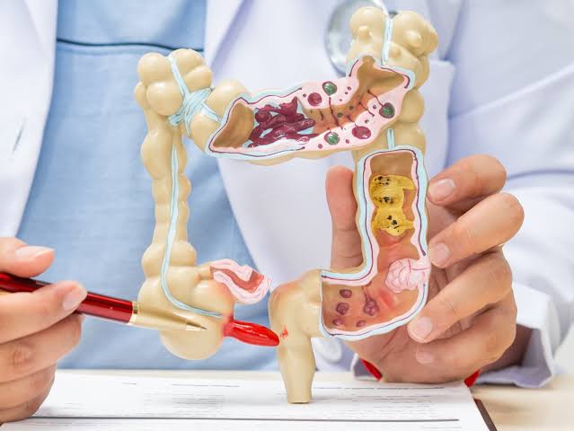 Appendicitis Treatment